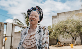 Bastina, 18, lives with albinism and is a member of Rapariga Biz, in Mozambique. 