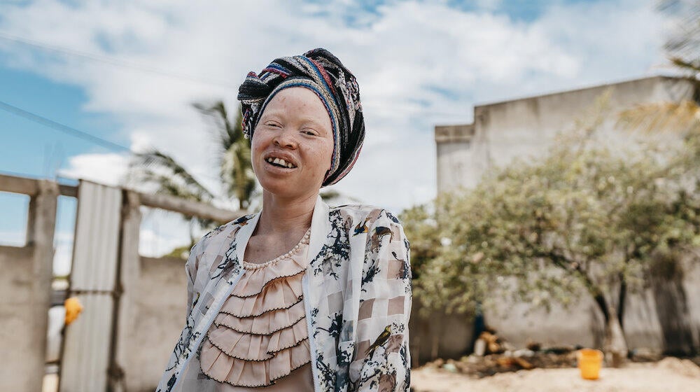 Bastina, 18, lives with albinism and is a member of Rapariga Biz, in Mozambique. 