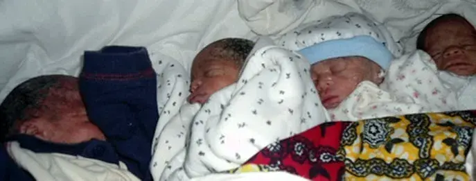 Quadruplets born in rural DRC, with help