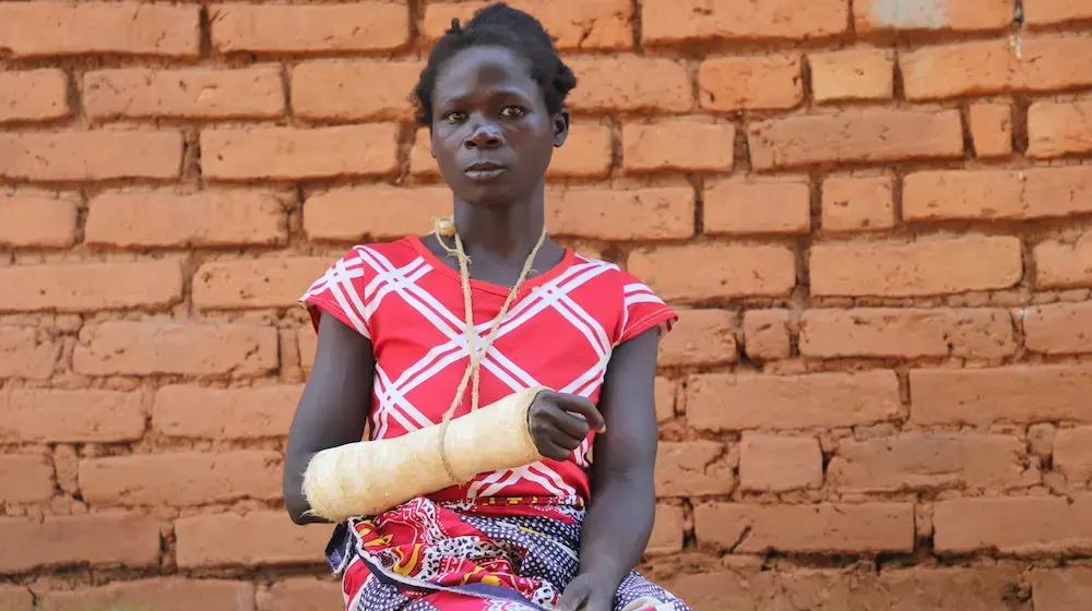 Hacked with a machete by her husband, young woman gets justice with Spotlight Initiative support